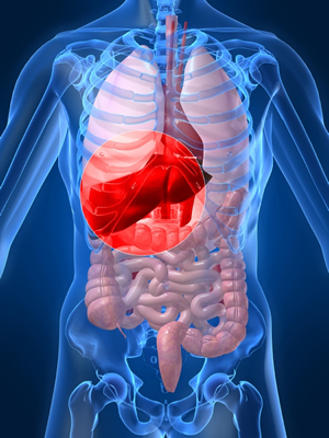 PLD Polycystic Liver Disease ADPKD: Candy's Story: Liver and Kidney Transplant